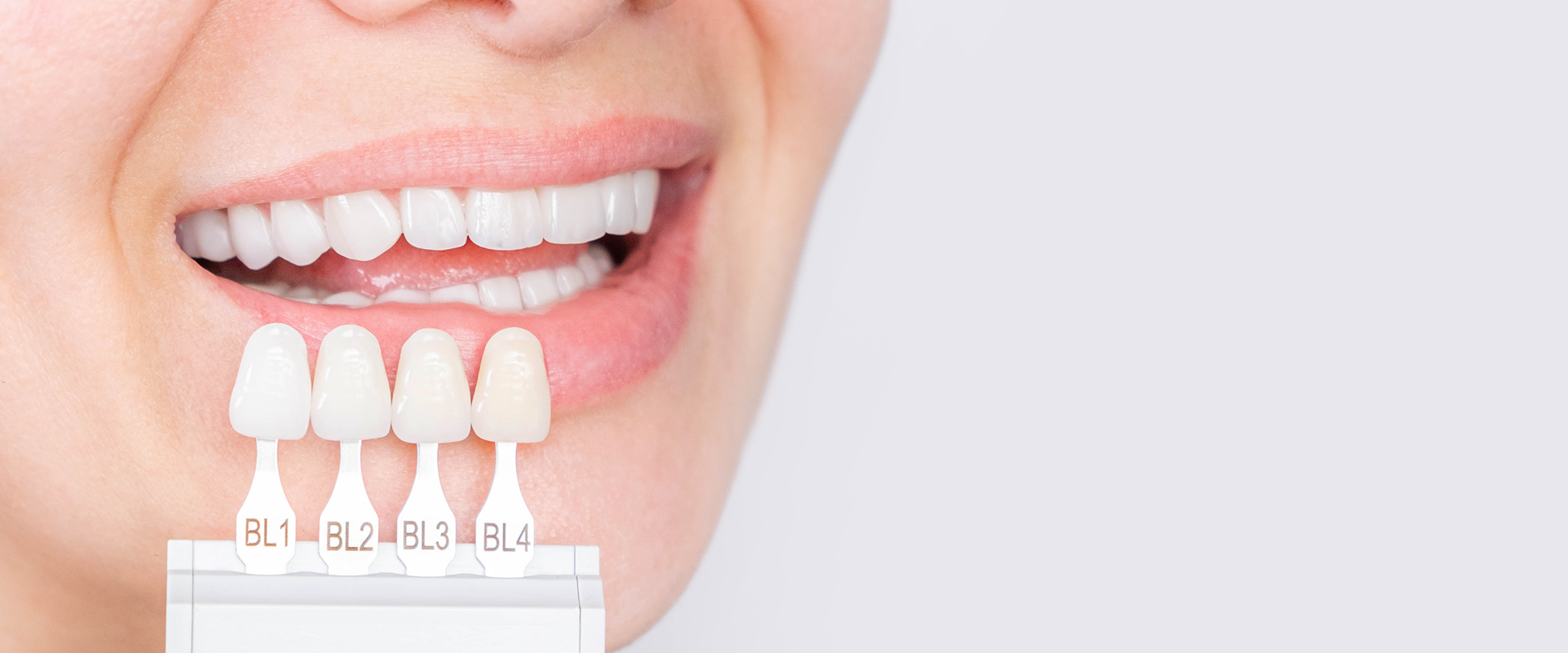Dental Veneers 