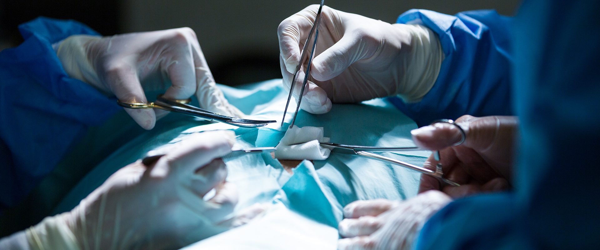 Cyst Tumor Removal 